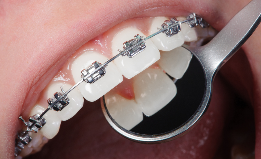 Orthodontie (ODF)