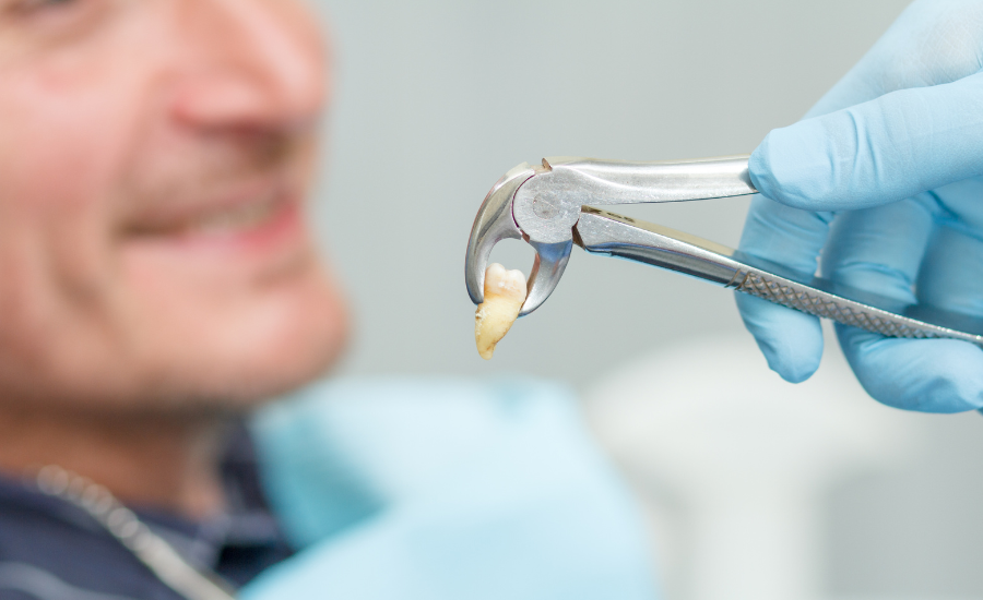 Petite Chirurgie et extractions dentaires